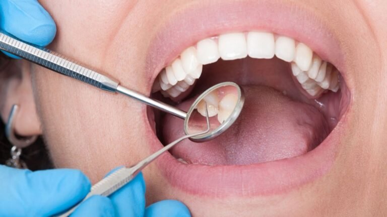 How to Prepare for a Smooth Molar Extraction Procedure