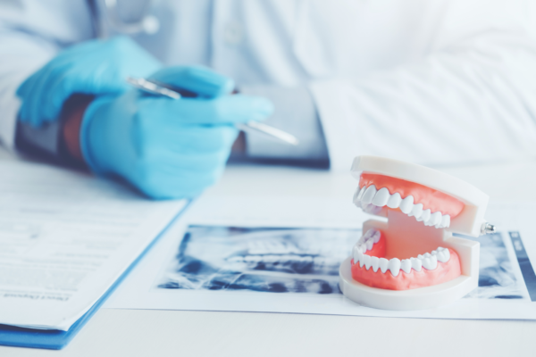 The Rise of Veneers in Hollywood: What Patients Should Know