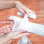 Wound Care in Arlington