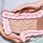 Long-Term Gut Wellness